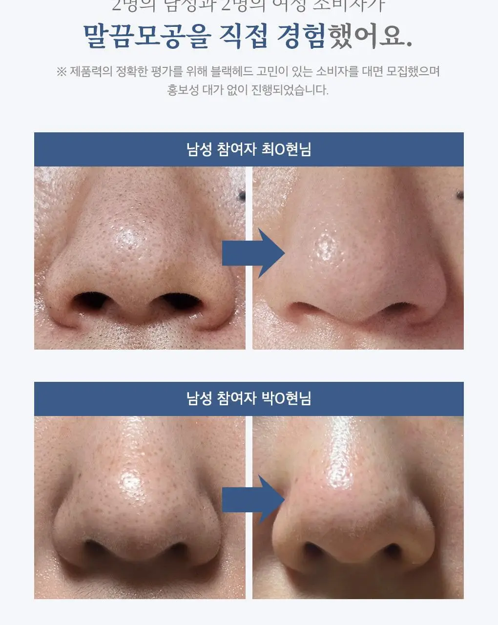 [블랙헤드관리/김다혜PICK] 비프로젝트 바이 블랙헤드 멜팅 리무버 30ml 상세페이지 21